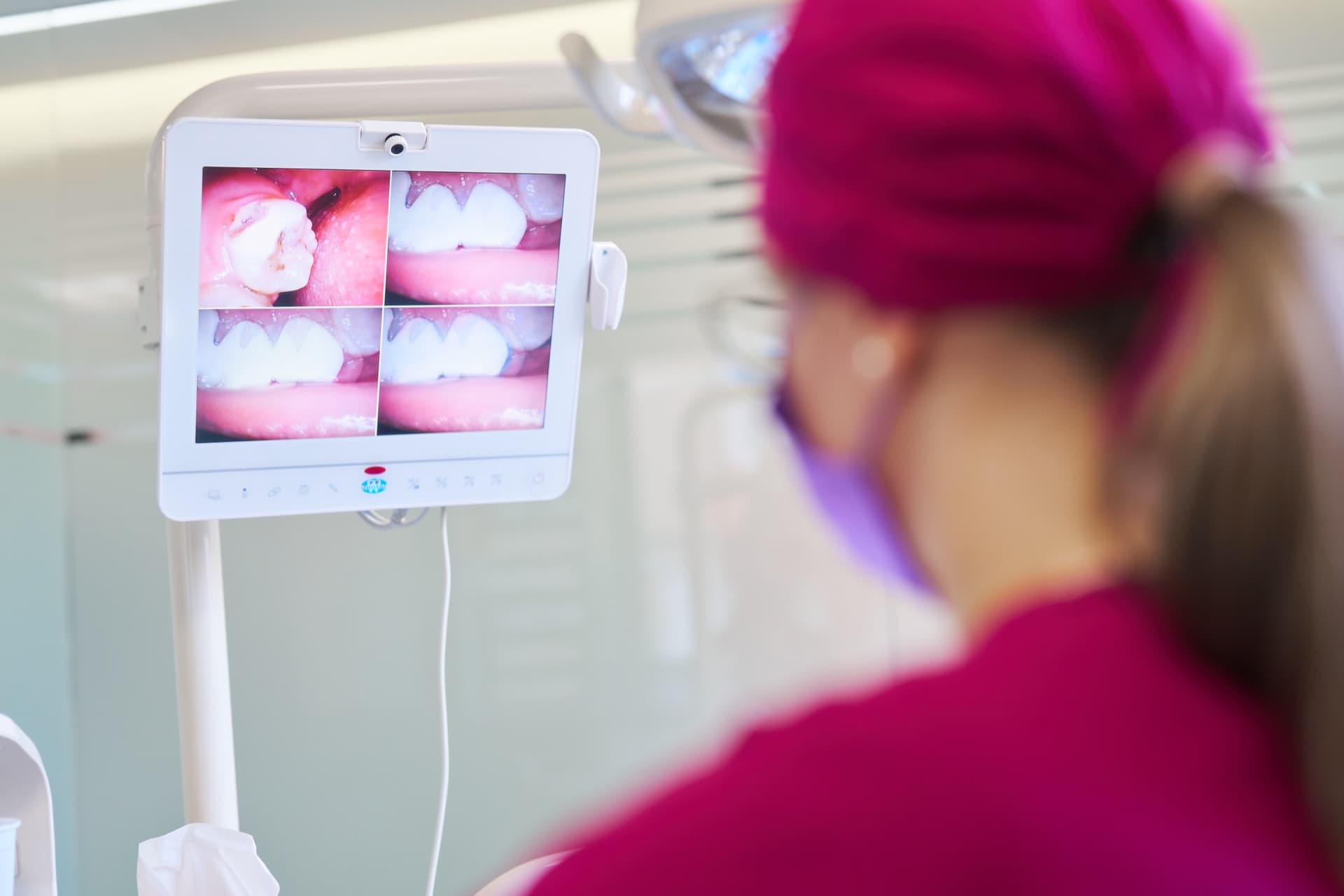 Zambet alb dupa albire dentara la Infinite Smile Sibiu