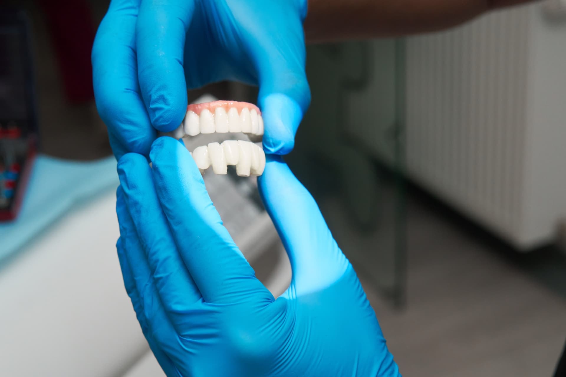 Lucrare protetică, coroană dentară la Infinite Smile Sibiu