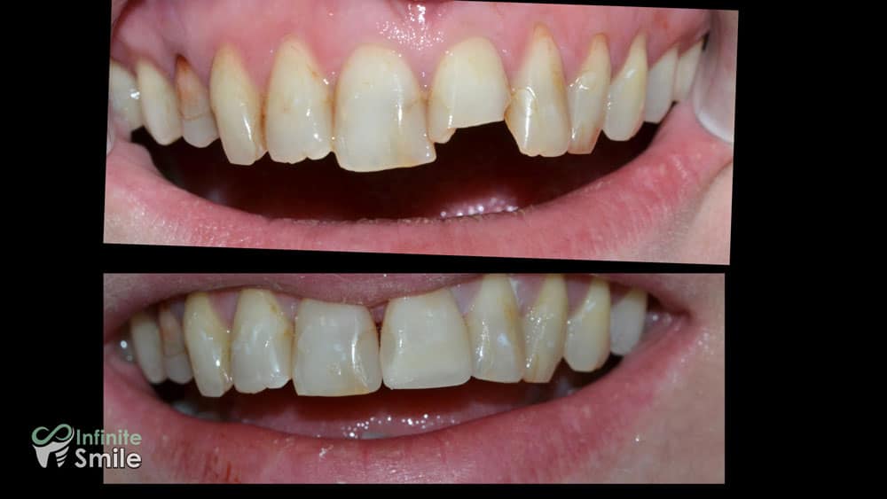 Sorrisi trasformati nella nostra clinica, 1
