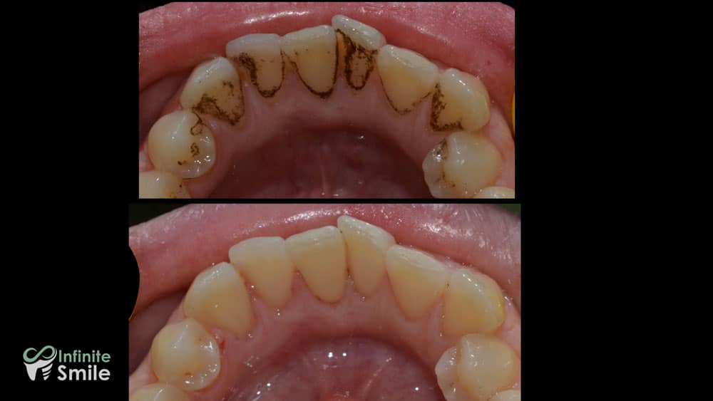 Sorrisi trasformati nella nostra clinica, 2