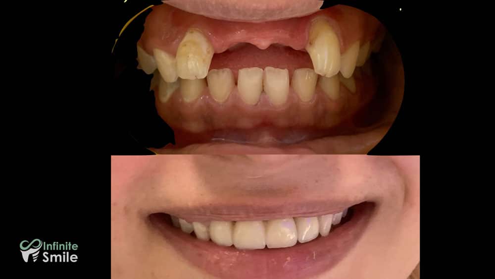 Sorrisi trasformati nella nostra clinica, 3
